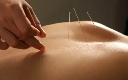 Acupuncture closeup