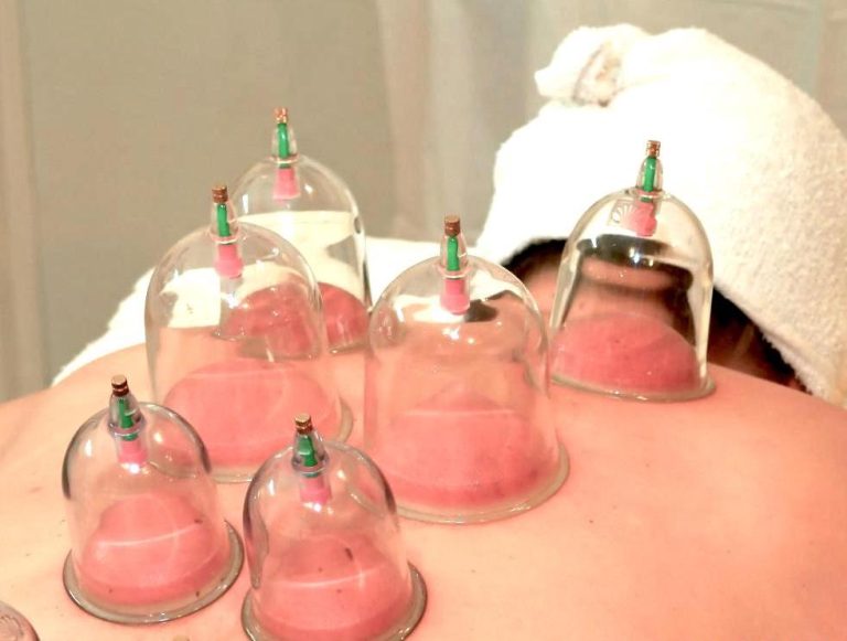 Discover the benefits of Chinese Cupping Therapy
